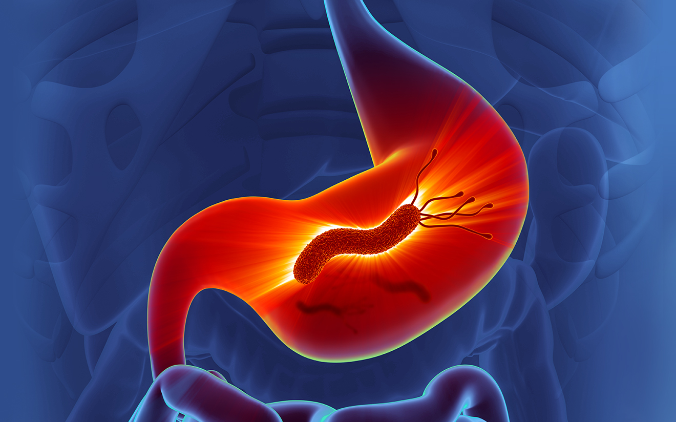 Антихеликобактерная терапия снижает риск развития проблем с ЖКТ