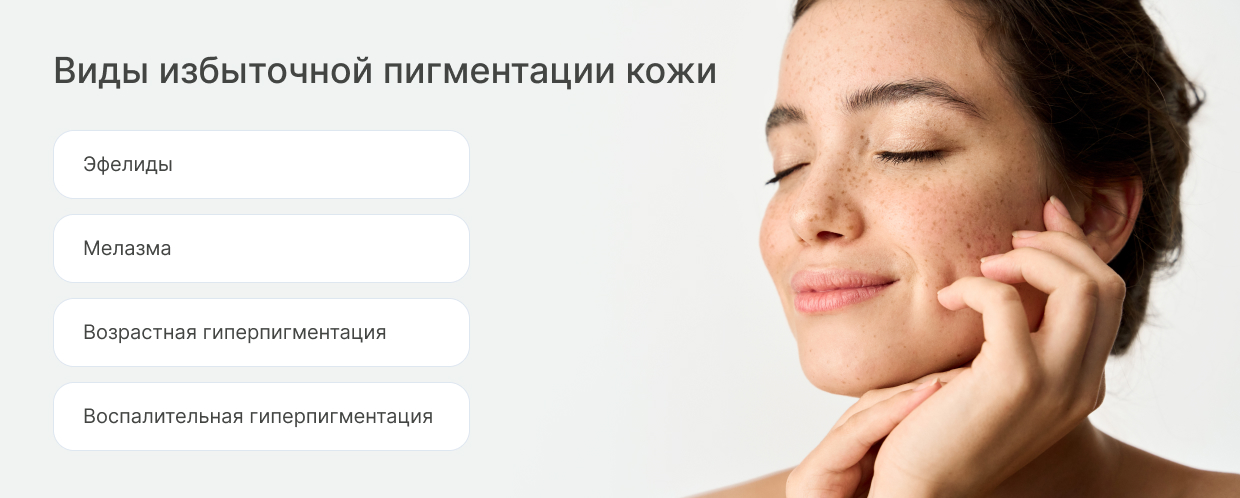 Виды пигментации.jpg